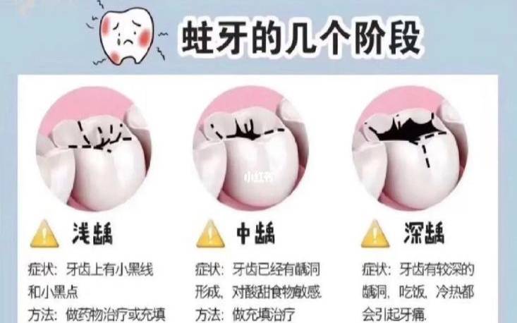 茶叶对龋齿的作用是什么,茶叶水漱口能防龋齿吗